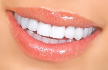 Woman Smiling After Teeth Whitening in Mount Pleasant SC